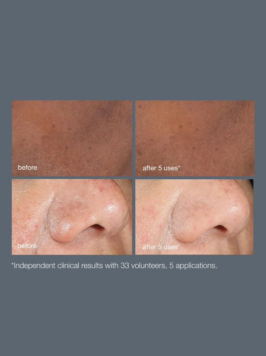 Powerbright Dark Spot Peel