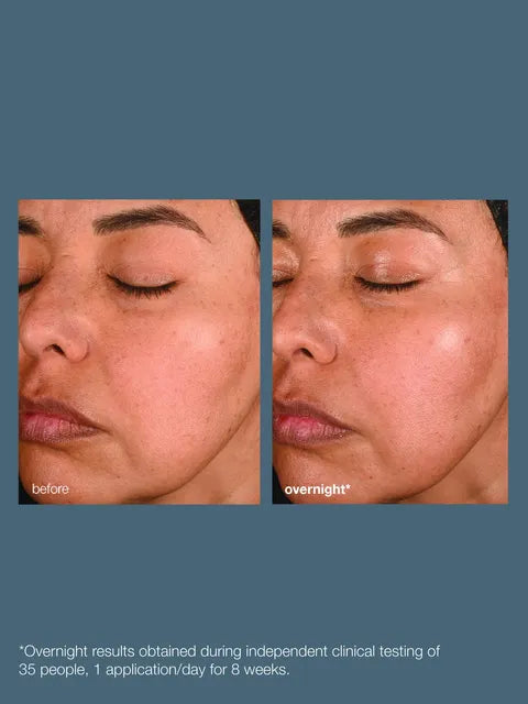 Biolumin C Night Restore Serum